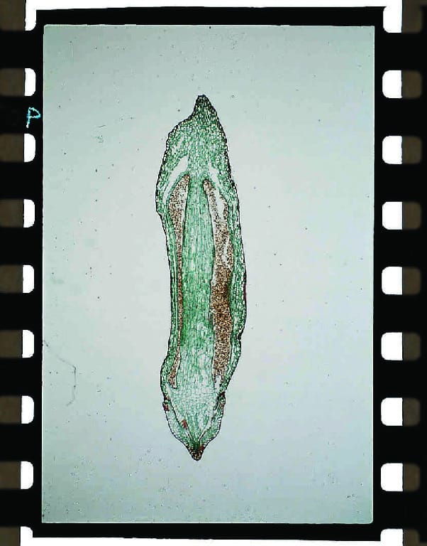 Ward's® Moss (Mnium) Slides
