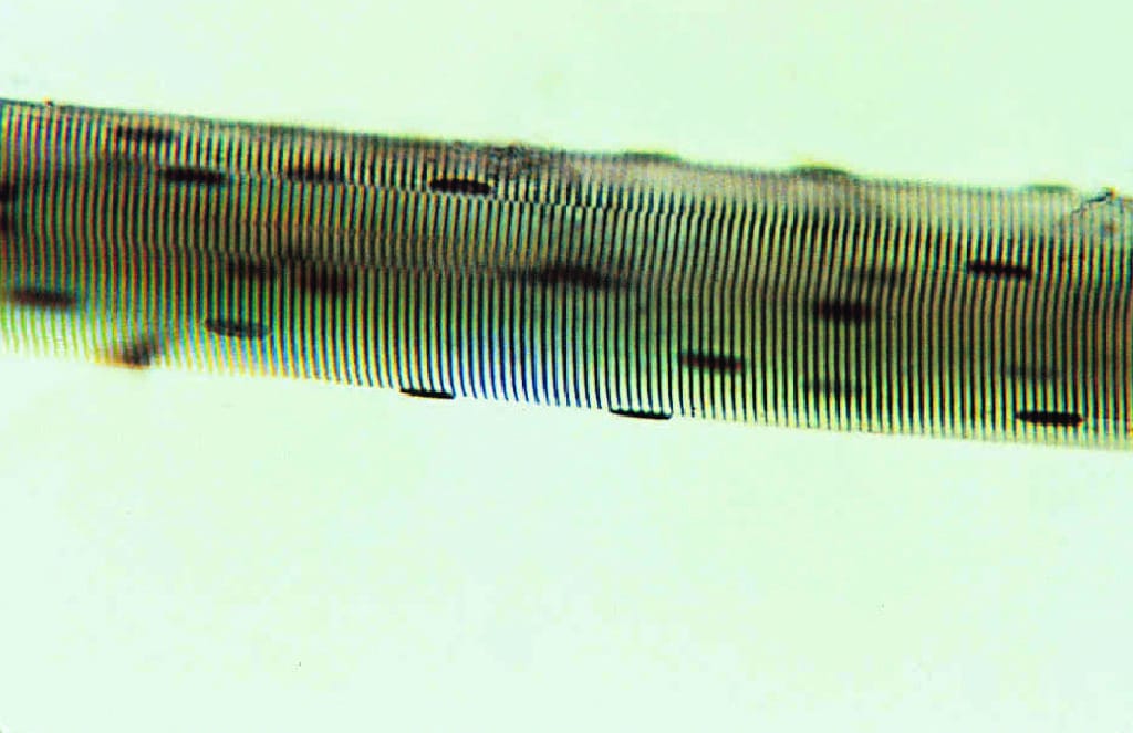 Skeletal Muscle, Teased Preparation Slide