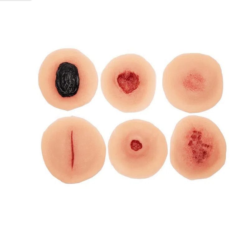Medicor® Sticky Wounds
