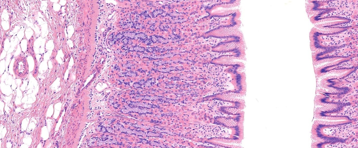 Stomach, Pyloric Region Slide