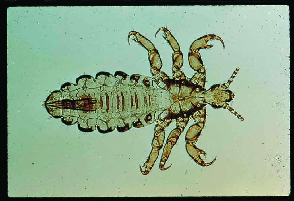 Pediculus humanus capitis, Adult Slide