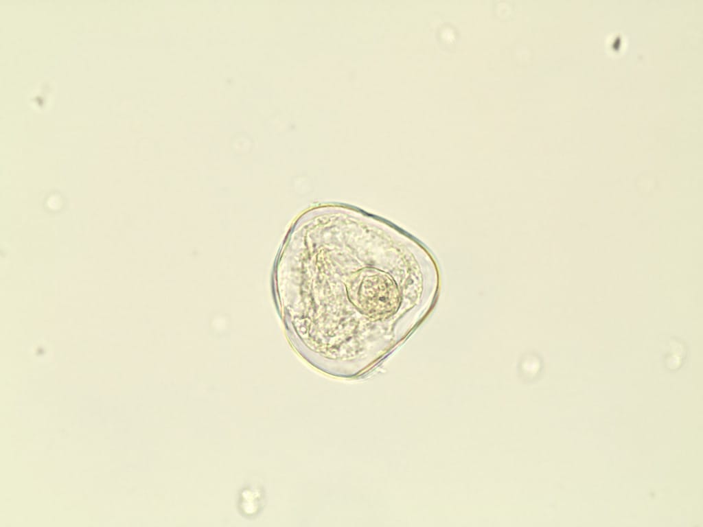 Moniezia expansa, Egg, Whole Mount Slides