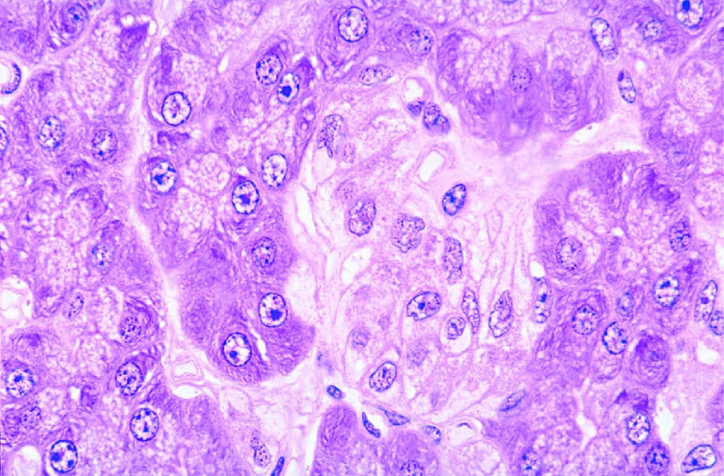 Mammalian Pancreas