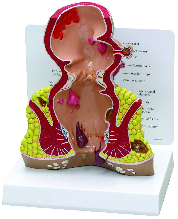 GPI Anatomicals® Rectum Model