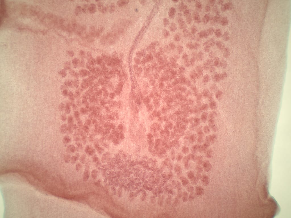 Taenia pisiformis, Mature/Gravid Proglottids Slide