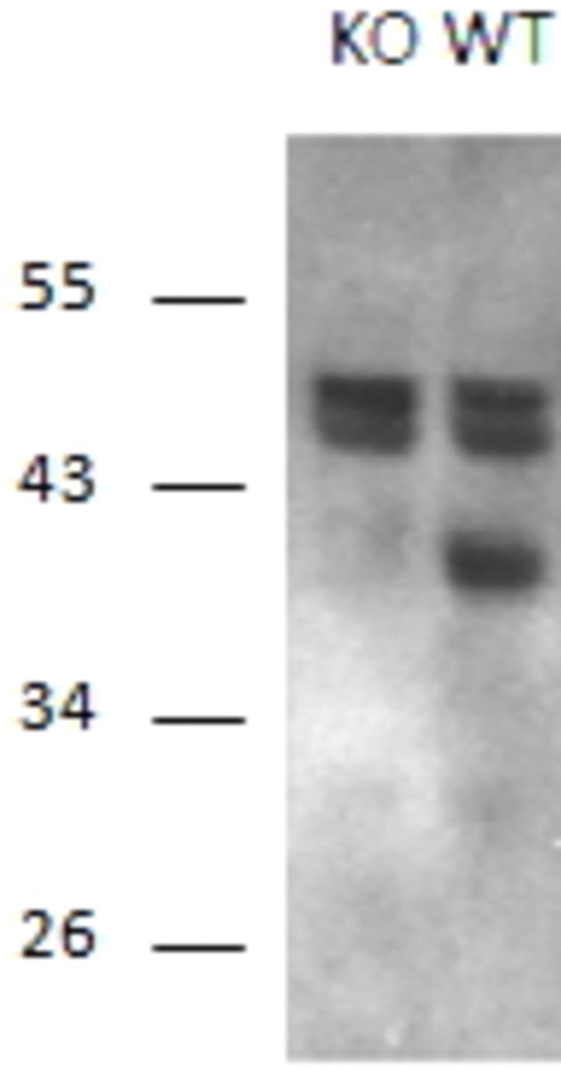 Anti-Calcipressin 1/RCAN1 Goat Polyclonal Antibody | VWR, part of Avantor