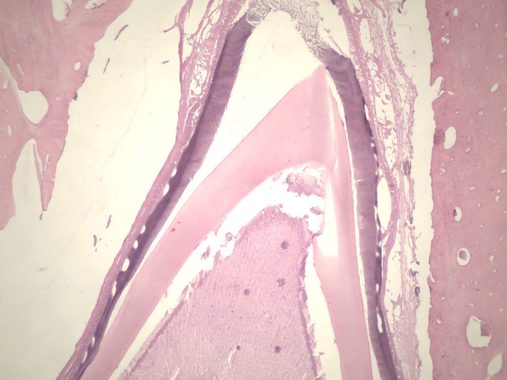 Tooth Development Slides