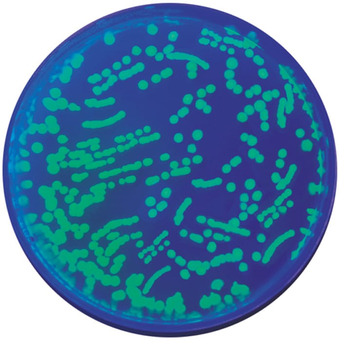 GFP Transformation Extension: Colony PCR (323), Edvotek