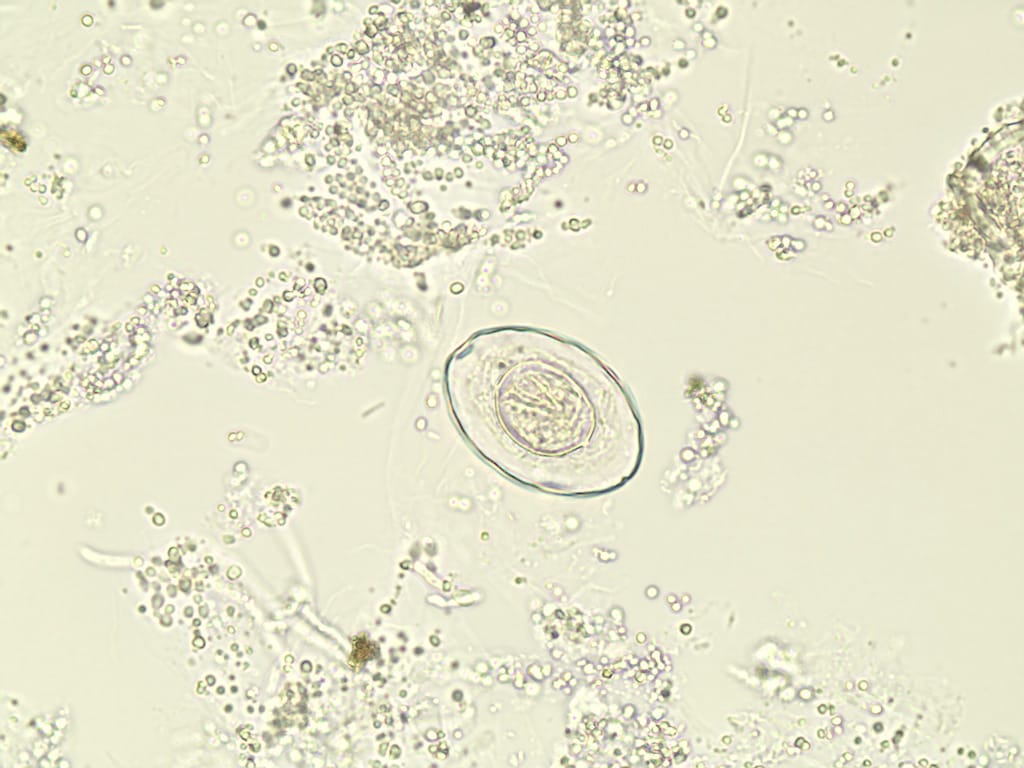 Hymenolepis nana, Eggs Slide