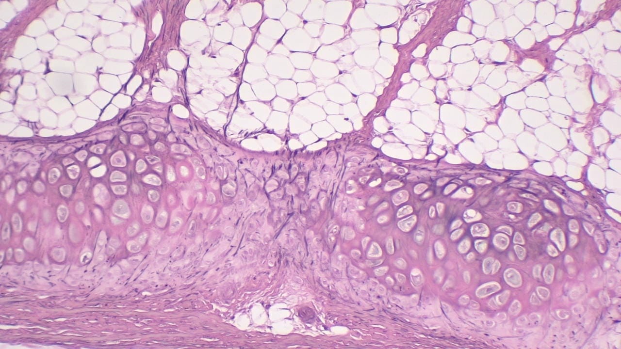 Elastic Cartilage, Mammal Slide