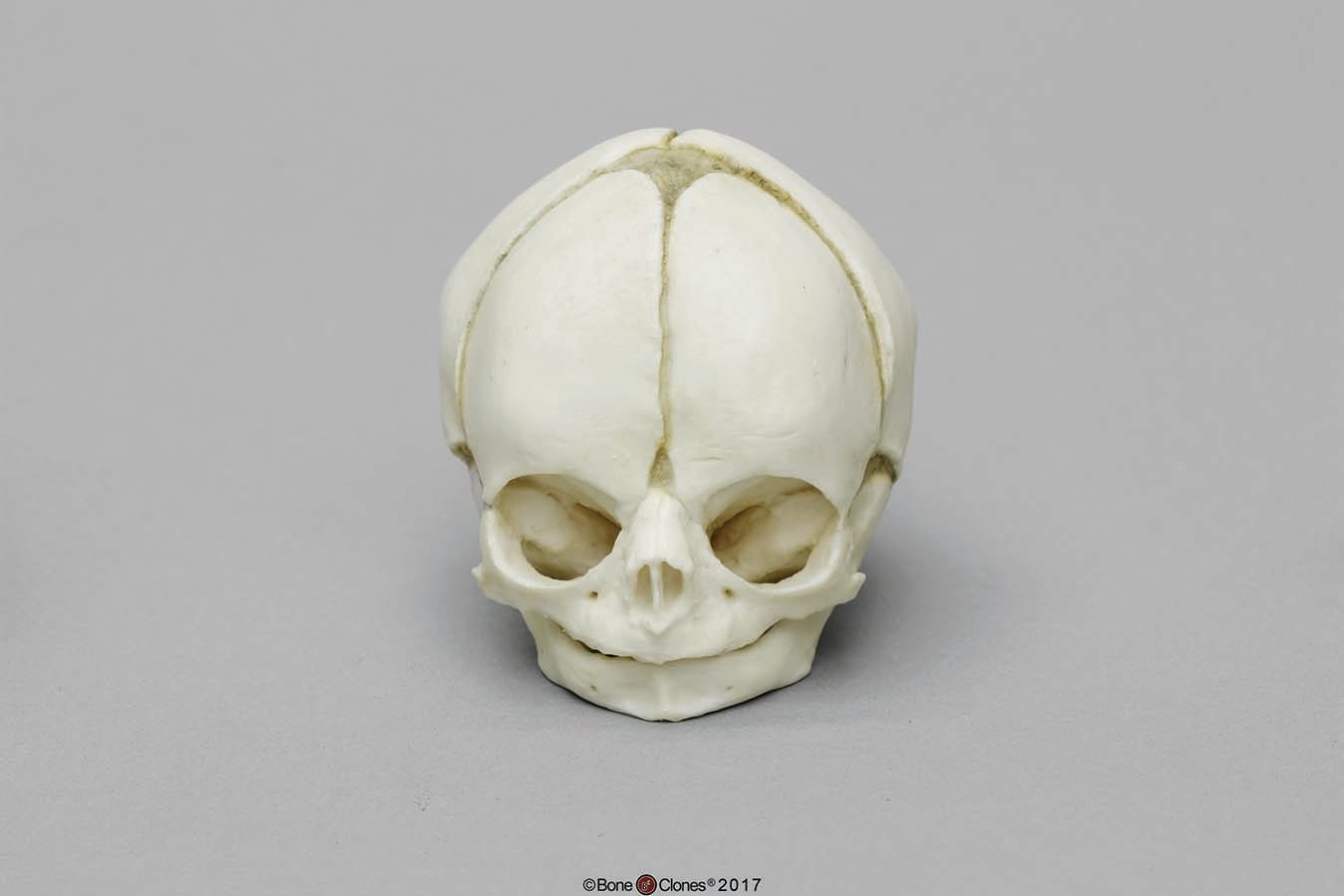 BoneClones® Fetal Skull Set
