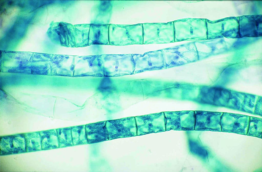 Spirogyra, Vegetative Slide