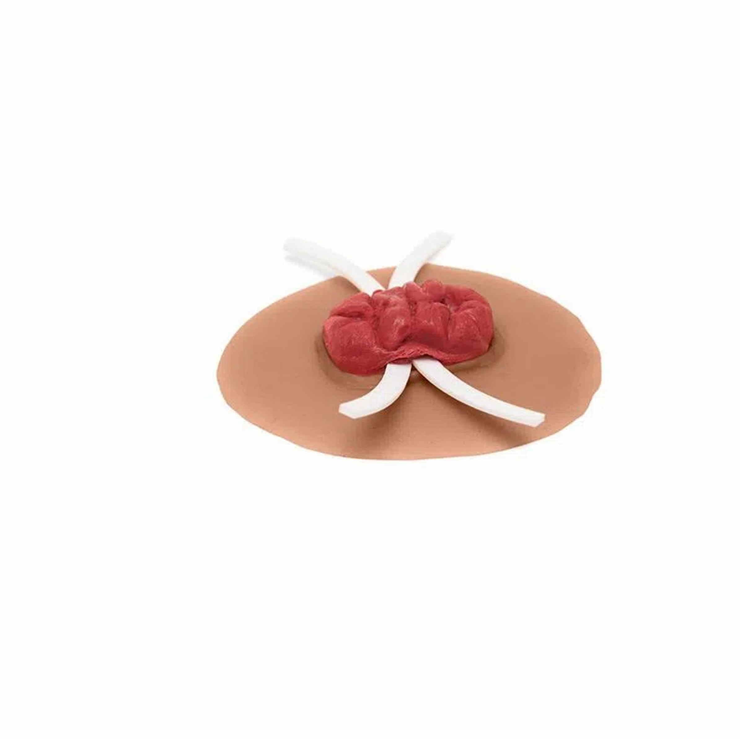 Medicor® Sticky Wounds