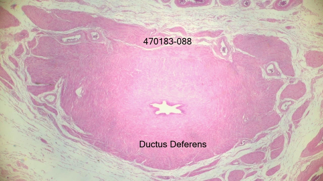 Spermatic Cord Slide