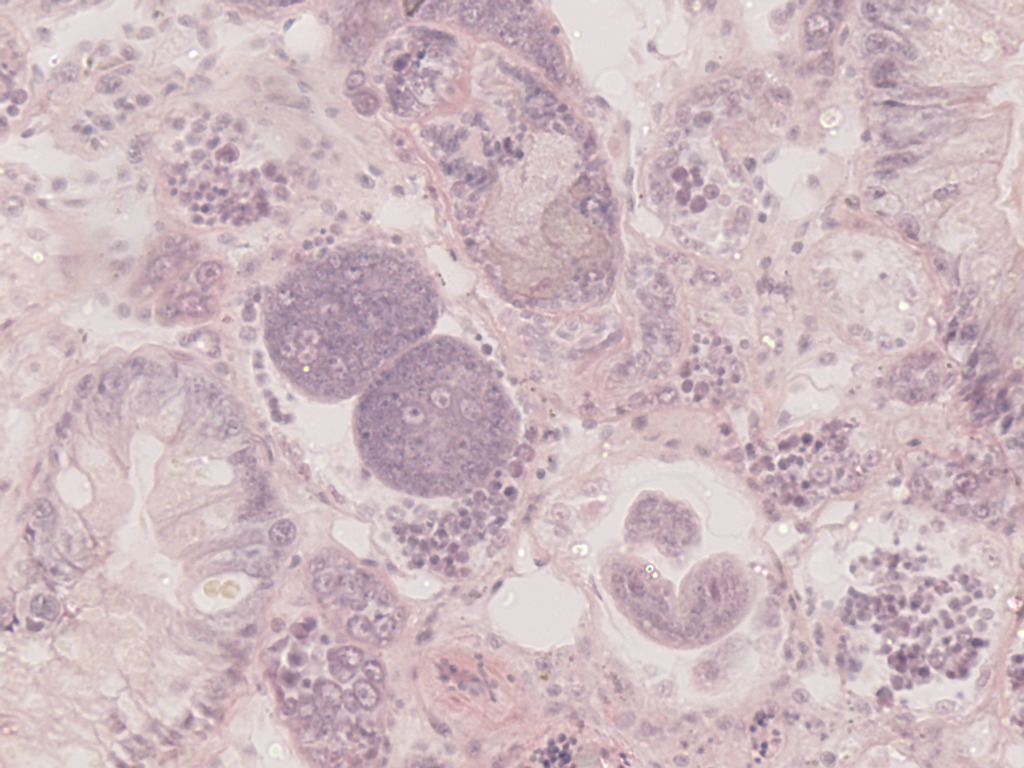 Schistosoma manson, Sporocyst Slide
