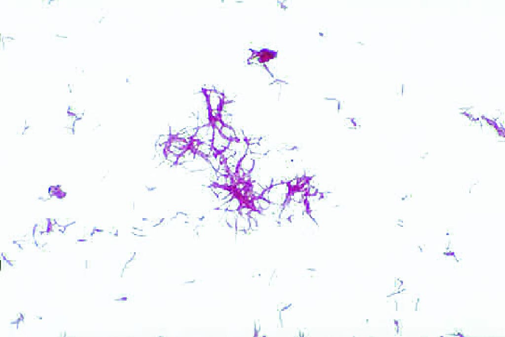 Mycobacterium tuberculosis Slide