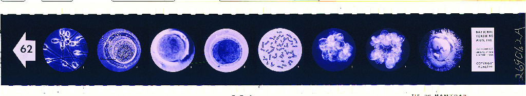 Human Reproduction Microslide