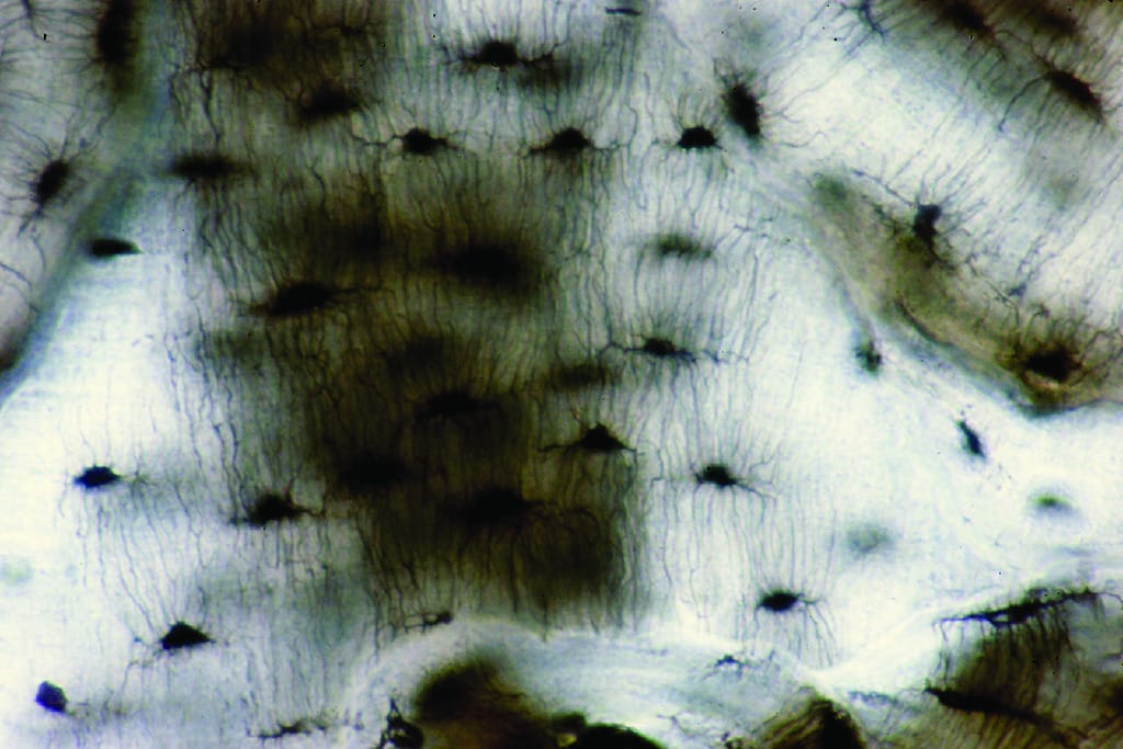 Human Bone, Ground Preparation Slide