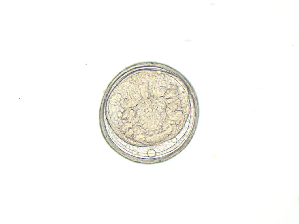 Fasciola hepatica, Metacercaria Slide