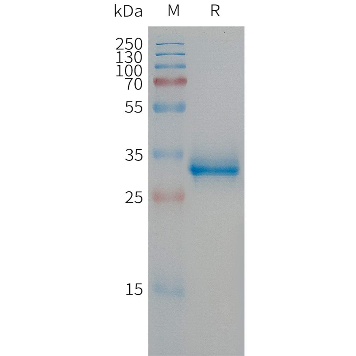 Human Recombinant CGRP-1 (from HEK293 Cells) | VWR, part of Avantor