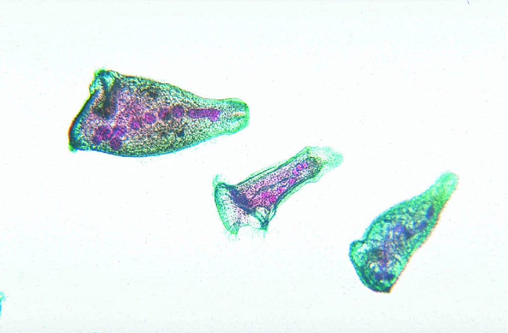 Stentor Slide