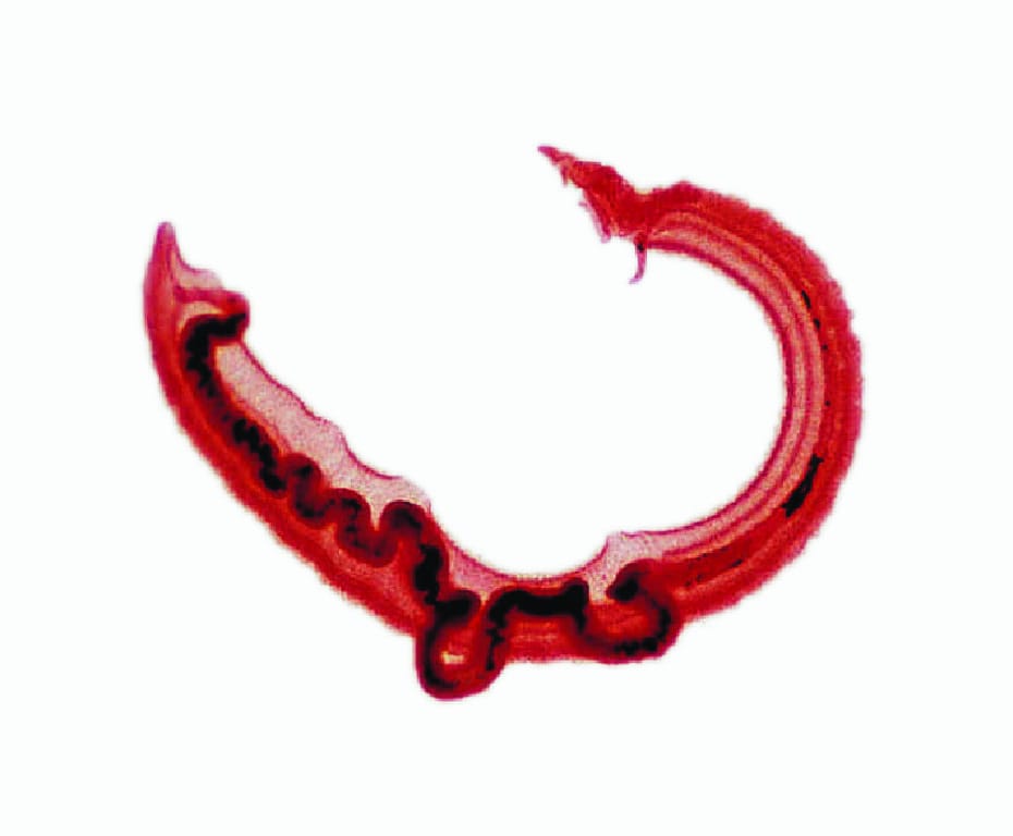 Schistosoma mansoni, Male/Female Slide