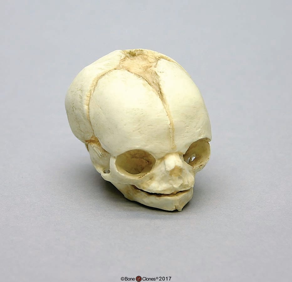 BoneClones® Fetal Skull Set