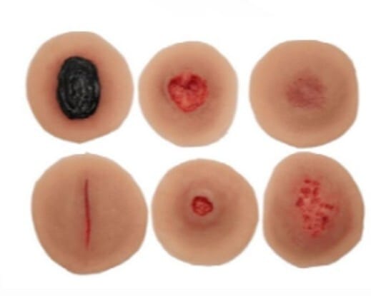 Medicor® Sticky Wounds