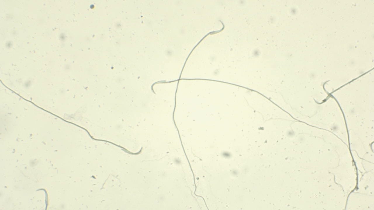 Sperm, Rat Slide