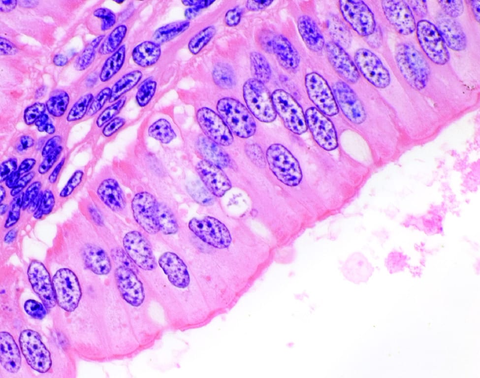 Urethra, Male Slide