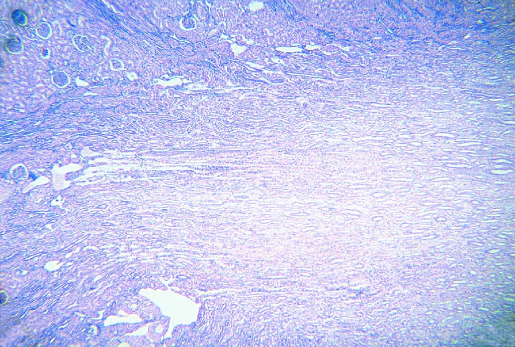 Kidney, Human Slide