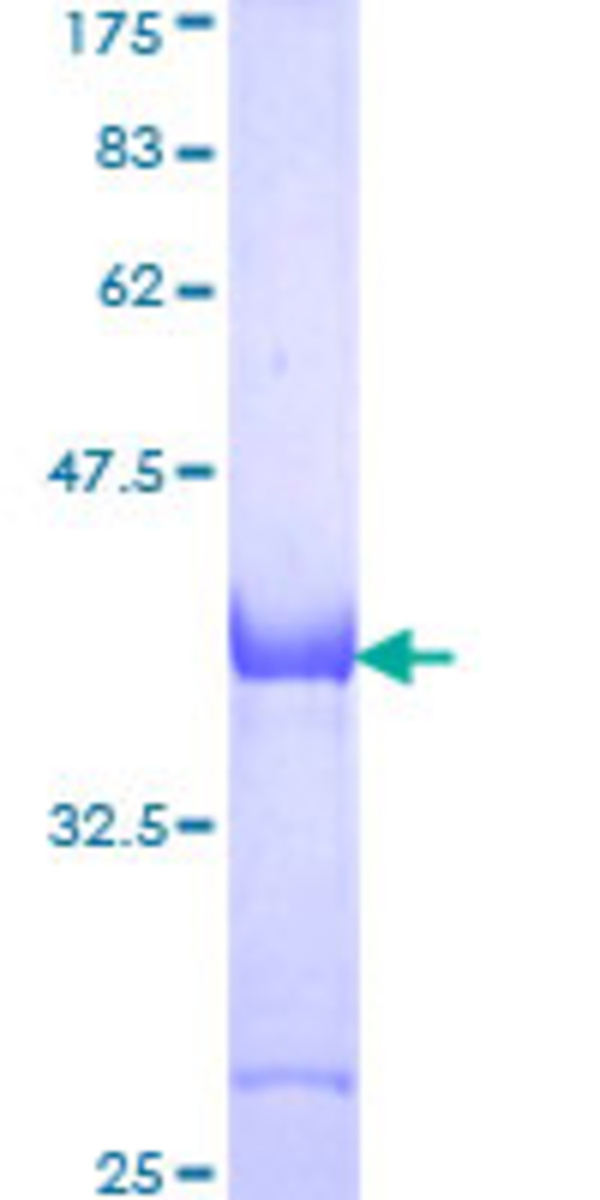 Human Recombinant ApoER2 (from Wheat germ) | VWR, part of Avantor