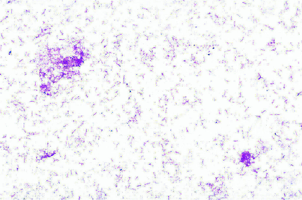 Shigella dysenteriae Slide