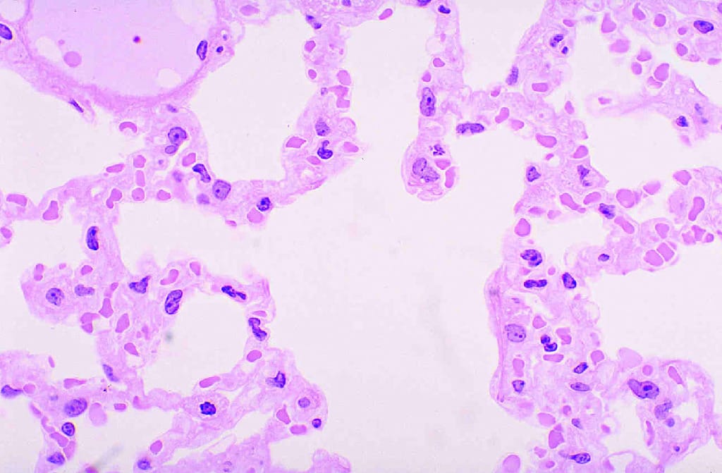 Lung Slide