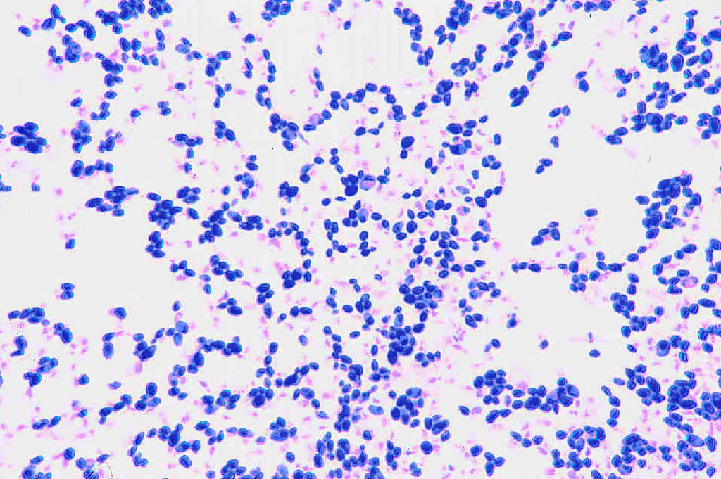 Candida albicans Slide