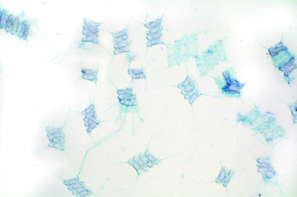 Mixed Dinoflagellates Slide