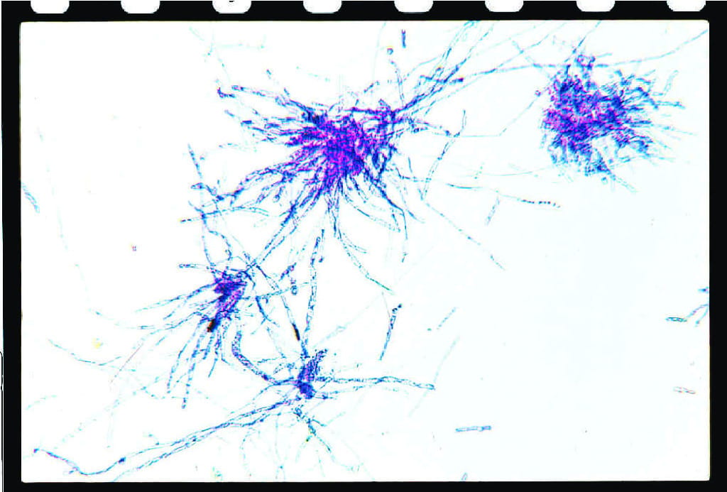 Ward's® Moss (Mnium) Slides
