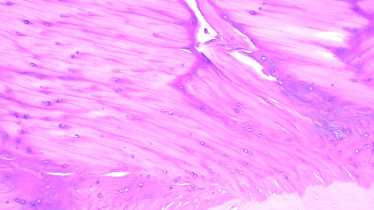 White Fibro-Cartilage, Intervertebral Disc Slide
