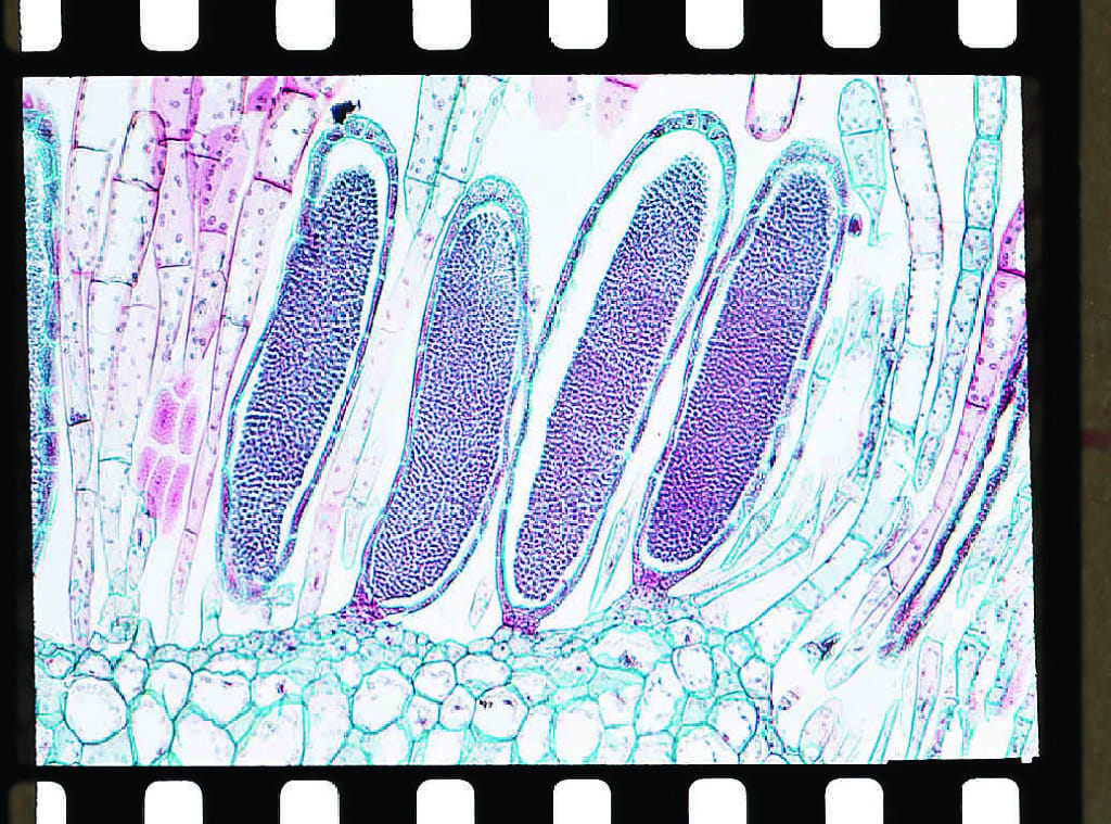Ward's® Moss (Mnium) Slides