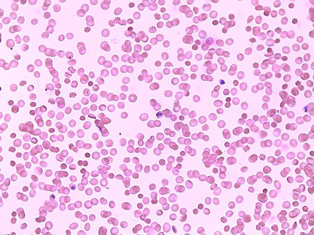 Plasmodium falciparum, Ring Stages Slide