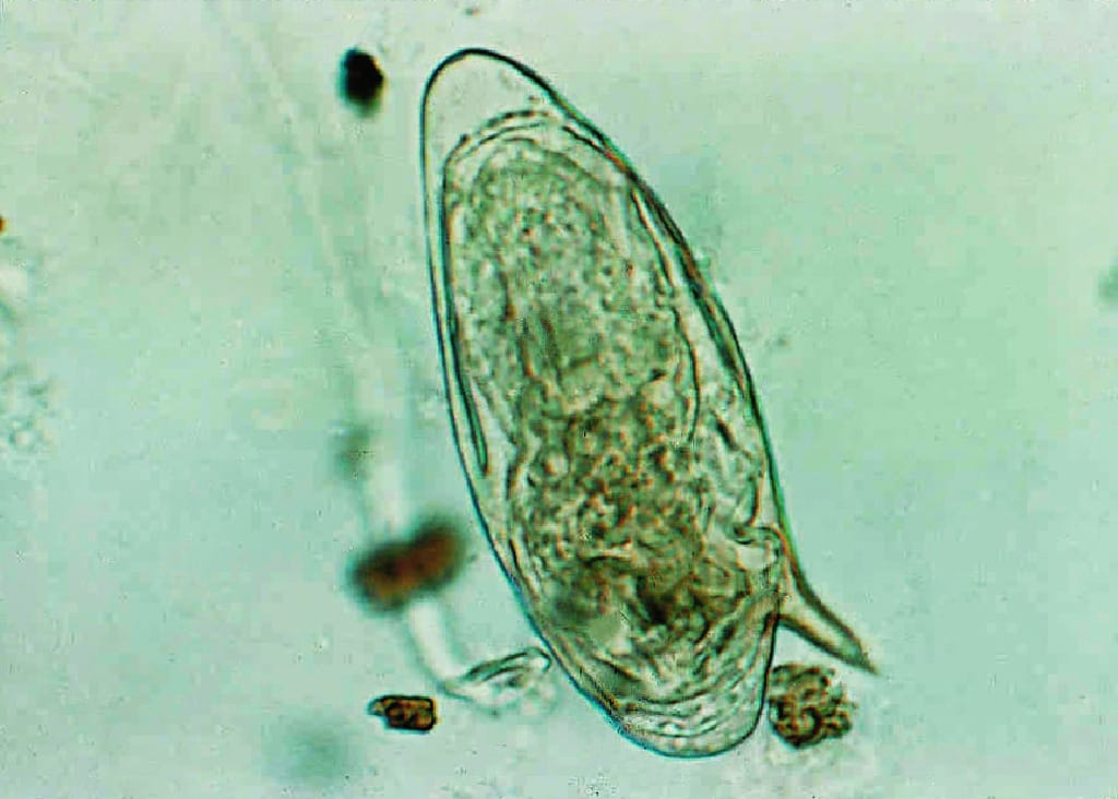 Schistosoma mansoni, Eggs Slide