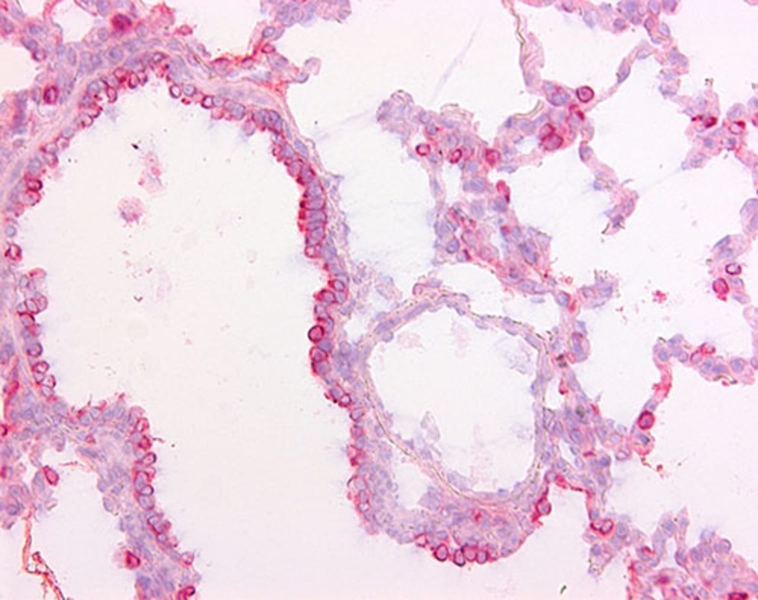 Anti-Surfactant protein D/SP-D Mouse Monoclonal Antibody [clone: 1.7 ...
