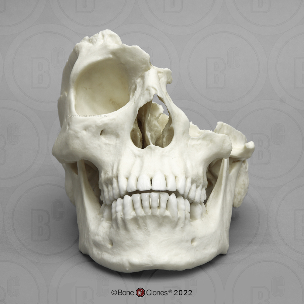 Bone Clones® Male Skull With Machete Wounds
