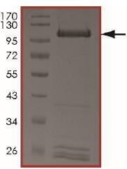 Human Recombinant Ret + PRKAR1A (from Baculovirus (Sf9 Insect cells ...