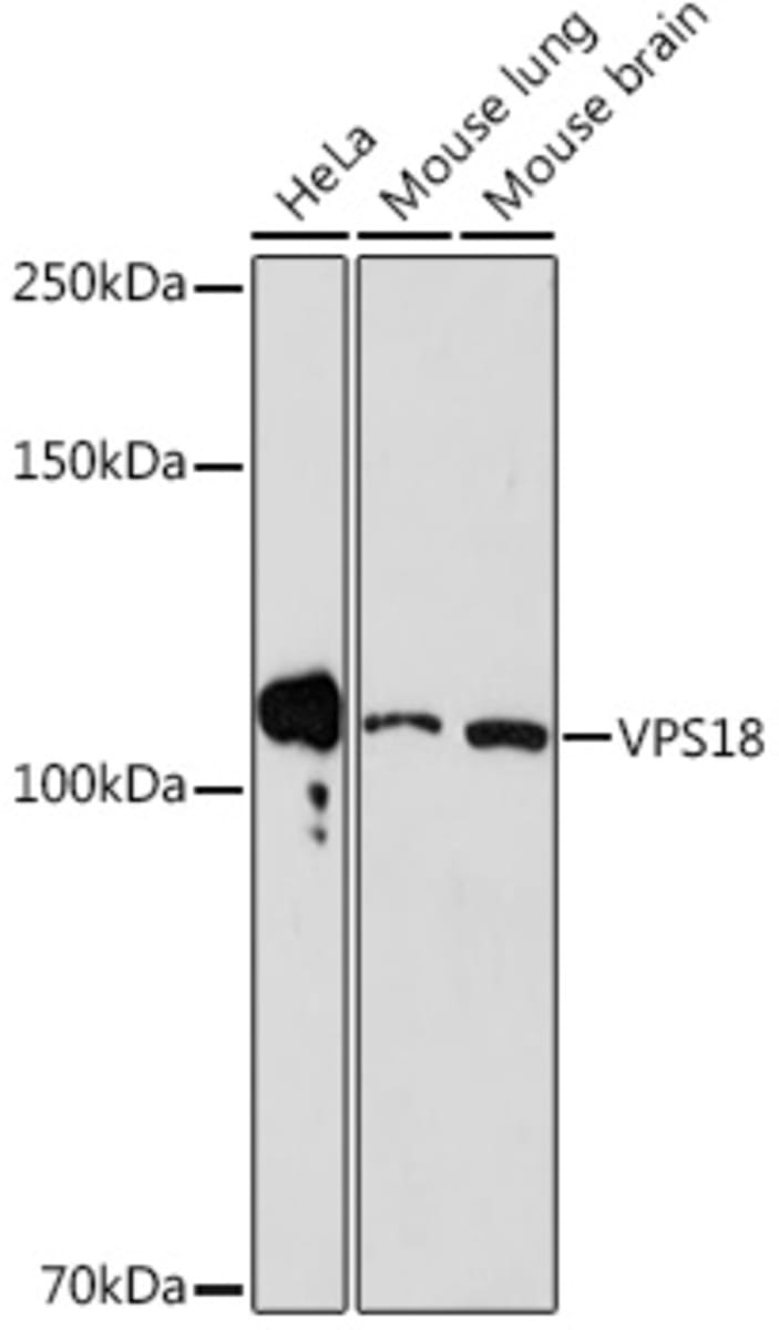 Anti-VPS18 Rabbit Monoclonal Antibody [clone: ARC2156] | VWR, part of ...