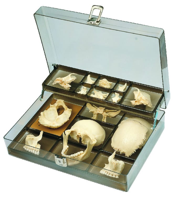 Somso® Disarticulated Skull