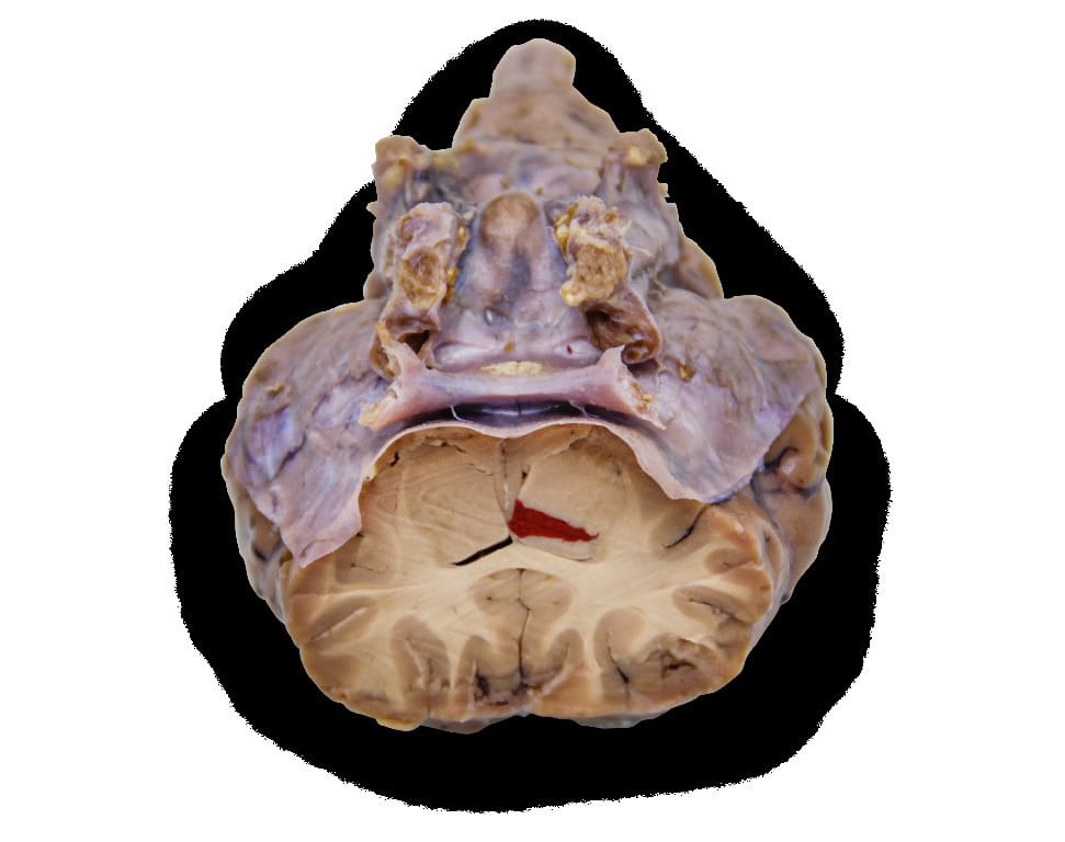 Ward's® Pure Preserved Sheep Brains with Simulated Tumors and Strokes