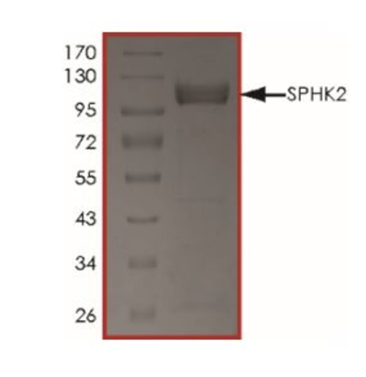 Human Recombinant SPHK2 (from Baculovirus (Sf9 Insect cells)) | VWR ...