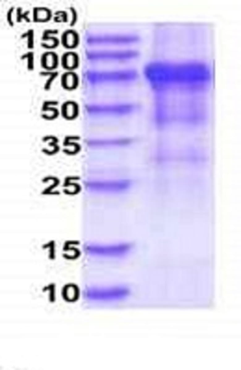 Human Recombinant KIR3DL2 (from Baculovirus (Insect cells)) | VWR, part ...
