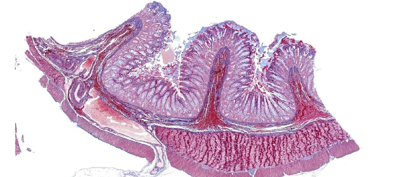 Auerbach’s Plexus, section, azan stained slides
